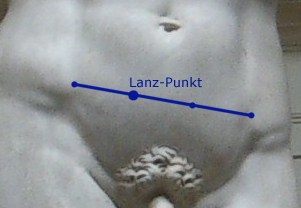 lanz noktası-26134