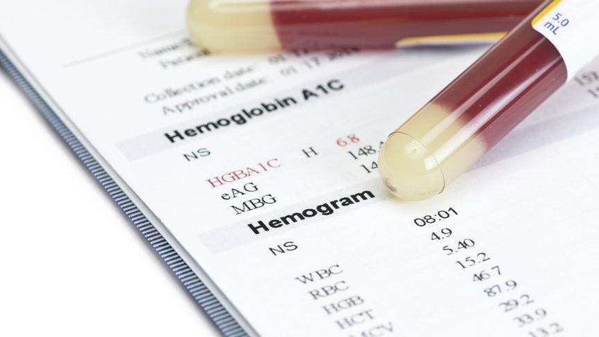 hemogram-25874