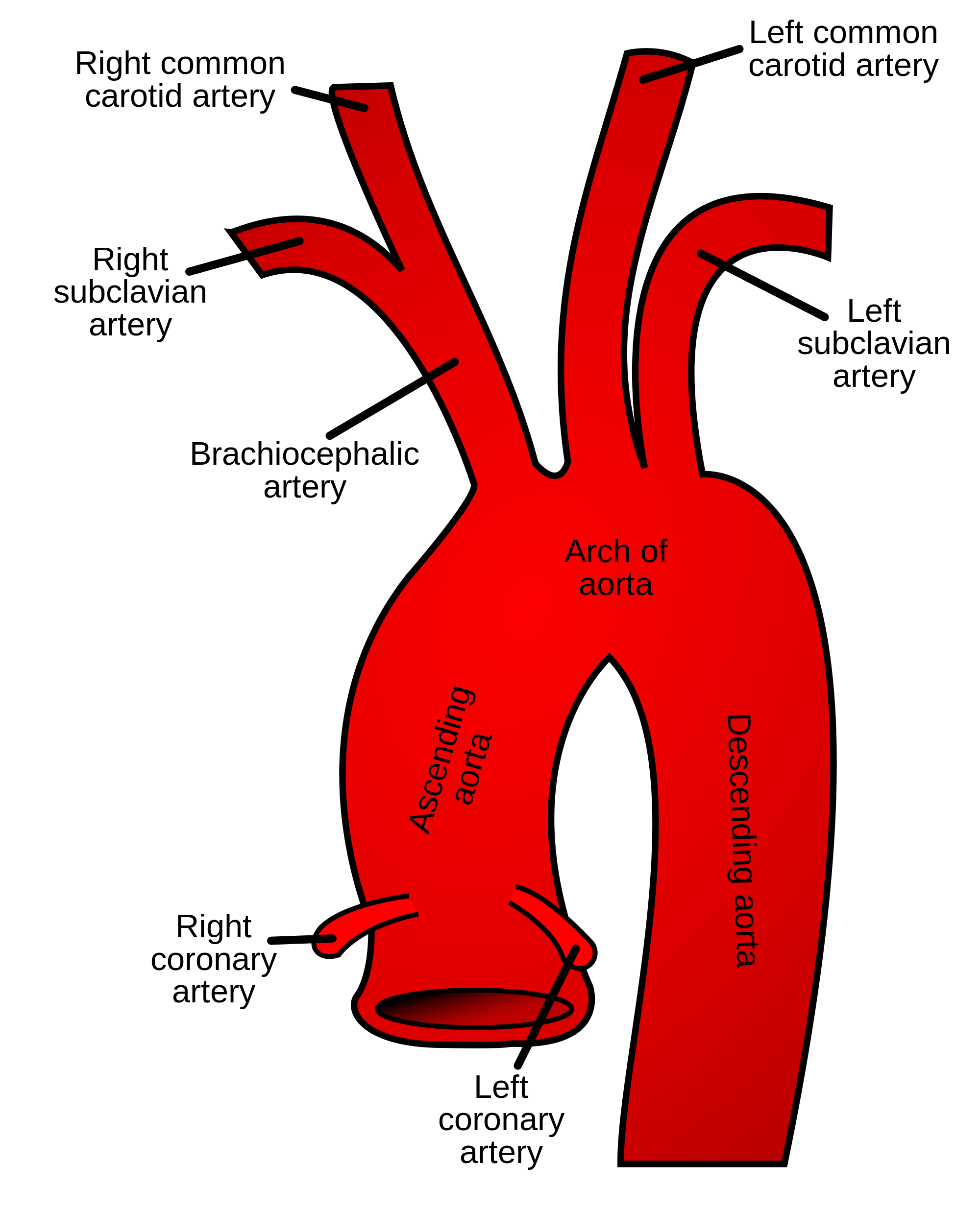 arteria carotis communis-1180