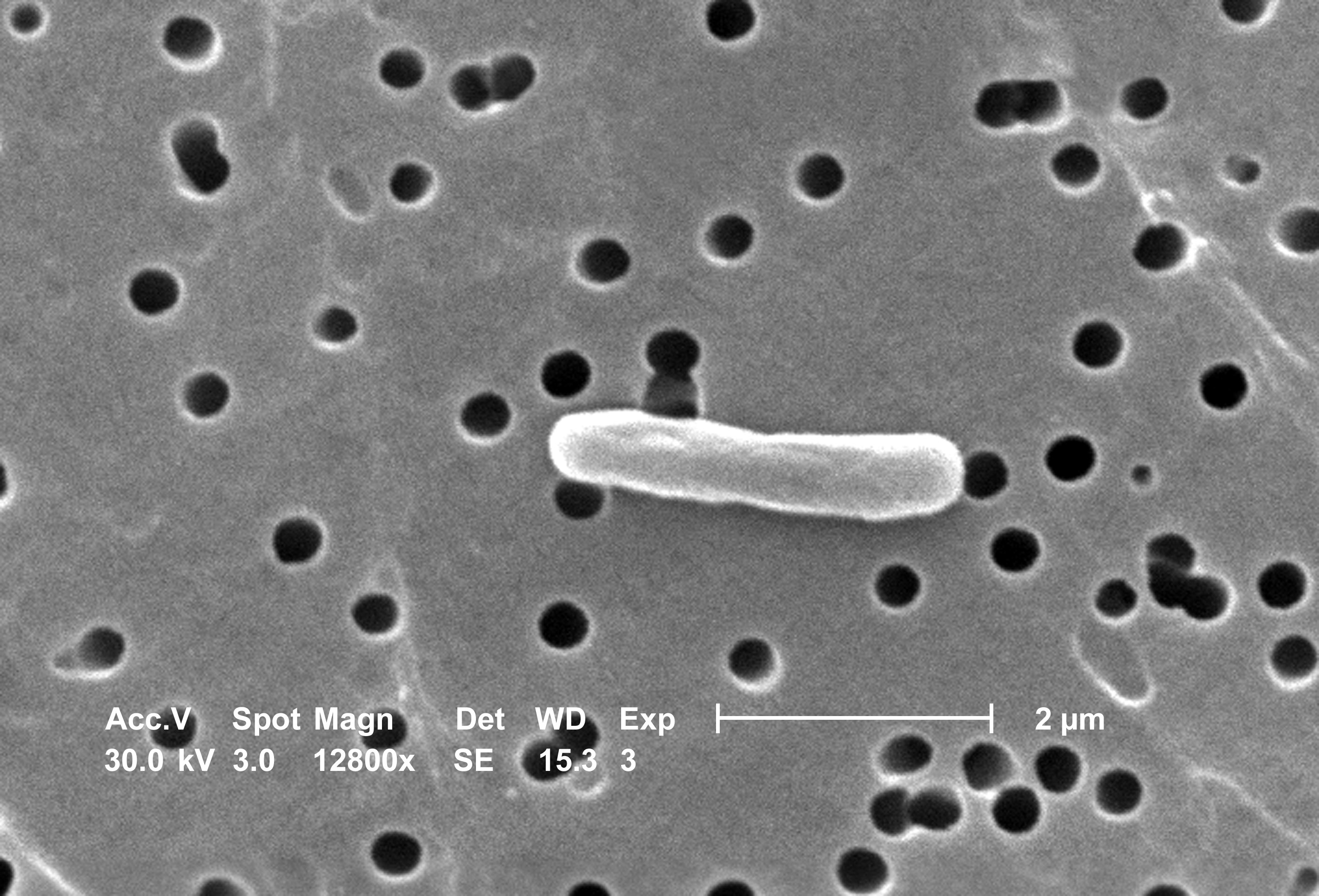 escherichia coli-13980