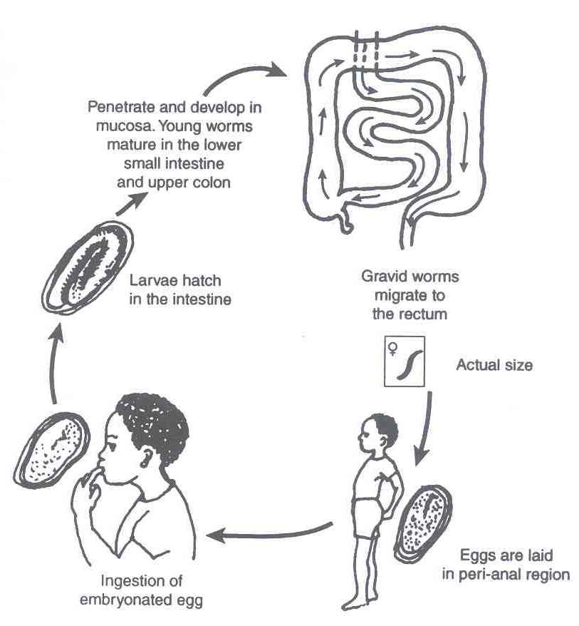 enterobius vermicularis-25159